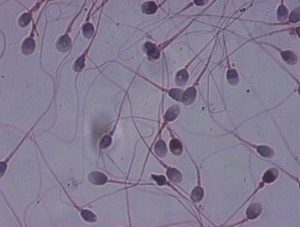 Oleh sperma dihasilkan Spermatogenesis, Proses