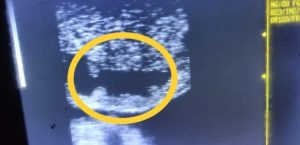 PEMERIKSAAN ORGAN REPRODUKSI DENGAN ULTRASONOGRAPHY ( USG )